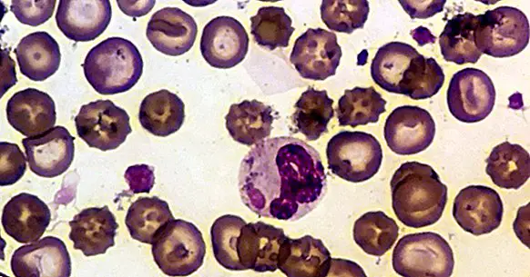 Erythrocytes (globules rouges): caractéristiques et fonctionnement