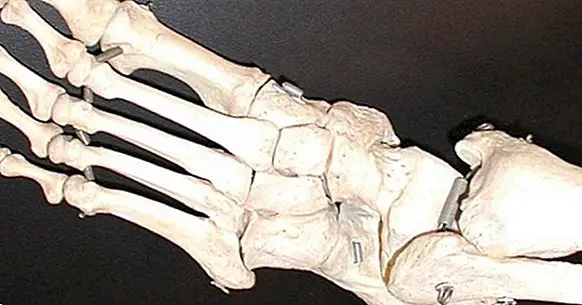 Wie viele Knochen hat der menschliche Fuß?