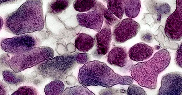 Mycoplasma genitalium :이 성병의 증상, 원인 및 치료