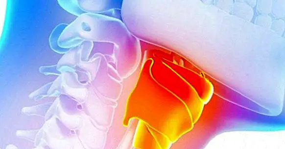 Cancro alla gola: 9 sintomi da considerare