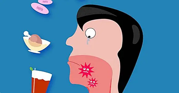 Miten hoitaa haavaumia ja haavaumia suussa suussa 8 vaiheessa
