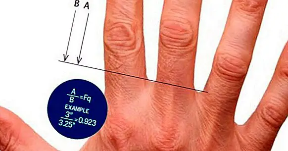 Die Länge der Finger deutet auf das Risiko einer Schizophrenie hin
