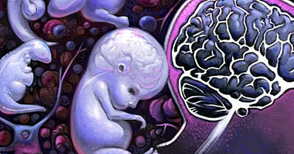 Vývoj mozku plodu a potrat: neurovědní výhled