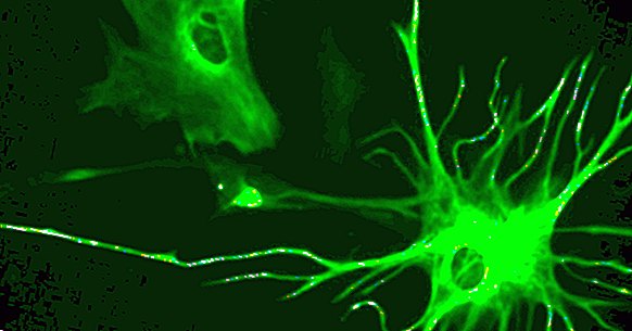 Astrocyte: katere funkcije izpolnjujejo te glialne celice?