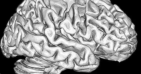Le cerveau créateur: où réside le génie