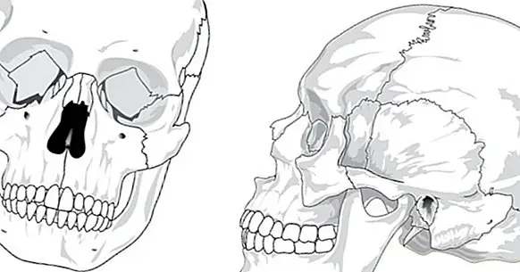 Кости на главата (череп): колко са и как се наричат?