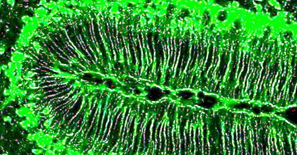 Radiális glia: mi az, és milyen funkciók vannak az agyban?