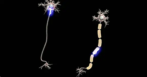 Quais são as partes do neurônio?