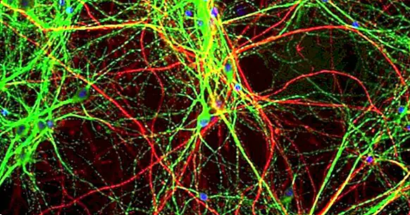 Anandamid: die Auswirkungen dieses Neurotransmitters auf das Gehirn