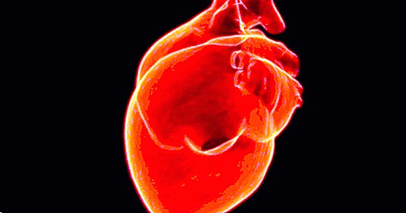 Types de tachycardie: symptômes et causes possibles