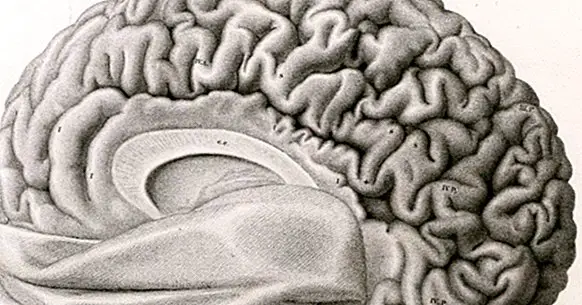 Les 12 maladies du cerveau les plus importantes