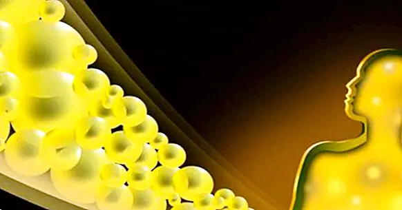 Hoher Bilirubin (Gelbsucht): Ursachen, Symptome und Behandlung