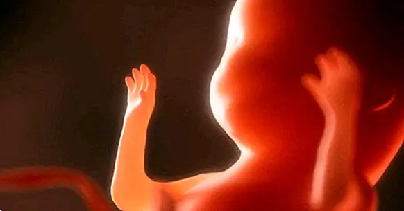 Fetal alcohol syndrome (FAS): symptoms, causes and treatment