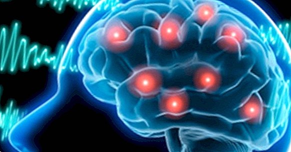Epilepsie: definice, příčiny, diagnóza a léčba