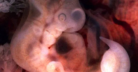 Die 3 Phasen der intrauterinen oder pränatalen Entwicklung: von der Zygote bis zum Fötus