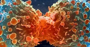 10 popularnih mitova o raku (i zašto su lažni) - medicine i zdravlja