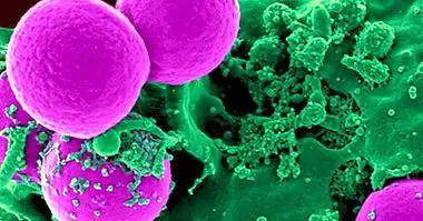 3 vrste bakterija (svojstva i morfologija) - medicine i zdravlja
