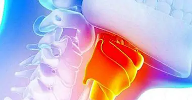 Cancro alla gola: 9 sintomi da considerare - medicina e salute