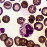 Erytrocyten (rode bloedcellen): kenmerken en functioneren - geneeskunde en gezondheid