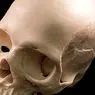 medicina e saúde: Como é o crânio humano e como se desenvolve?