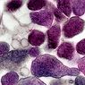 την ιατρική και την υγεία: Mycoplasma genitalium: συμπτώματα, αιτίες και θεραπεία αυτής της STD