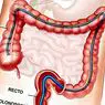 Medicine and health: Colonoscopy: what is this medical test used for?