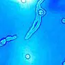 Miodesopsias: plovoucí skvrny, které brání vidění - medicíny a zdraví
