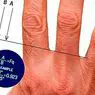 The length of the fingers would indicate the risk of suffering schizophrenia - neurosciences