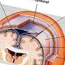 невронауки: Арахноид (мозък): анатомия, функции и свързани с нея заболявания