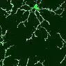 neurovidenskab: Microglia: hovedfunktioner og tilhørende sygdomme