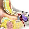 10 חלקים של האוזן ואת תהליך קבלת קול - מדעי המוח