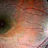 neurosciences: Optic nerve: parts, path and related diseases