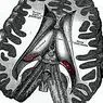 Diencephalon: struktura in funkcije te možganske regije - nevroznanosti