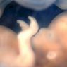 νευροεπιστήμες: Από πότε ένα ανθρώπινο έμβρυο αισθάνεται πόνο;