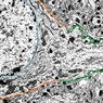 ソーマの神経細胞またはpericarion：部品および機能 - 神経科学