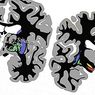 neurovidenskab: Sort stof: hvad det er, funktioner og beslægtede lidelser