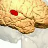 Oblast Wernicke: anatomie, funkce a poruchy - neurovědy
