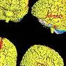 Laut einer Studie ist das weibliche Gehirn aktiver als das menschliche Gehirn - Neurowissenschaften