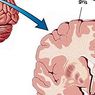 Aivojen harmaasiirtymä: rakenne ja toiminnot - neurotieteiden