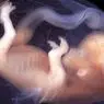 تطور الجهاز العصبي أثناء الحمل - علم النفس التربوي والتنموي
